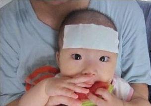 发烧吃瓜娄,揭秘瓜娄背后的健康之谜