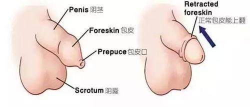 割完包茎可以吃哈密瓜吗,哈密瓜可以吃吗？营养与恢复两不误